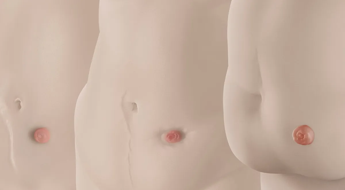 Bodycheck